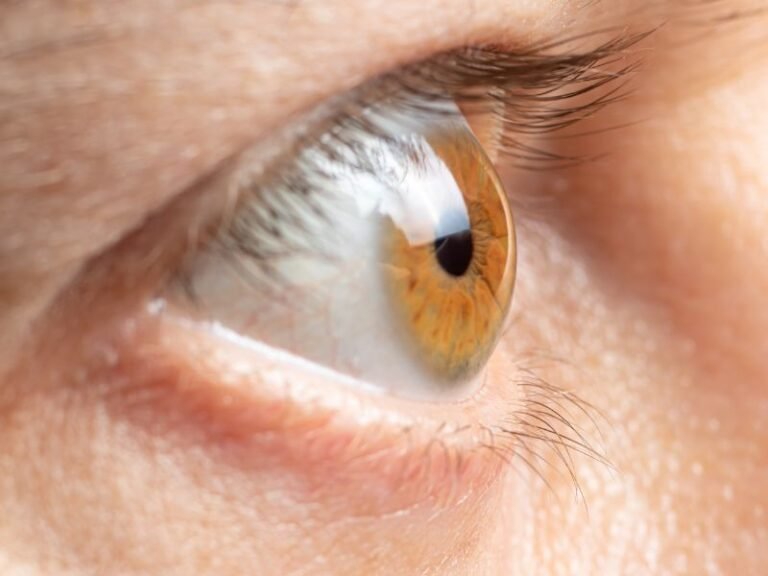 Inovacoes no Tratamento do Glaucoma em Curitiba